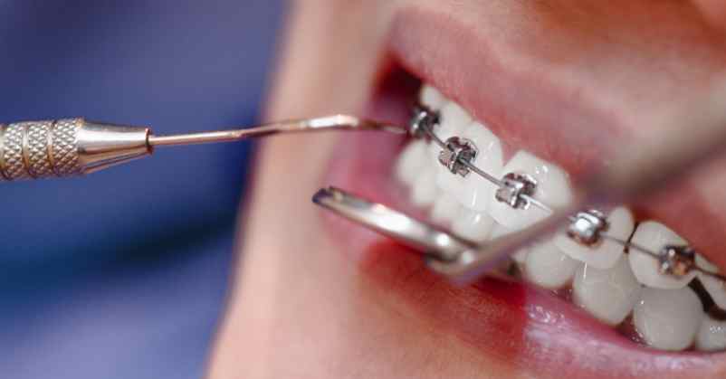 Pourquoi ne faut-il pas le faire ? Biennale de Laudun